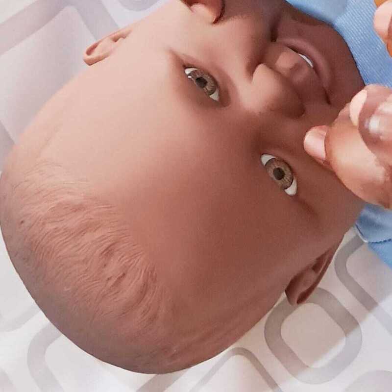 Sinus (1) (1) Sinus (1) (1)